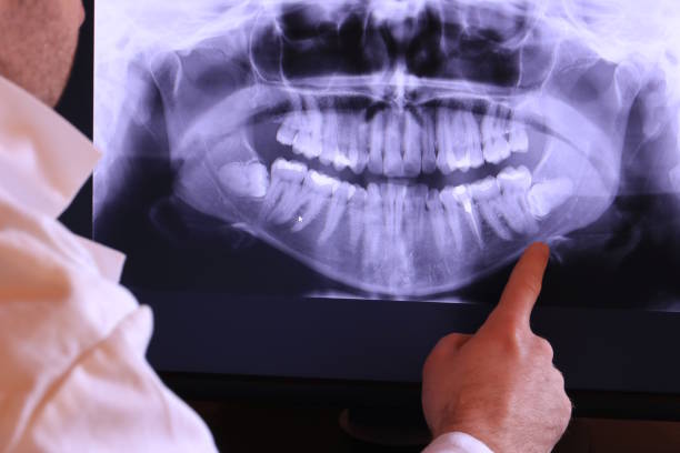 Best Mobile Emergency Dentist in Fairfield Glade, TN
